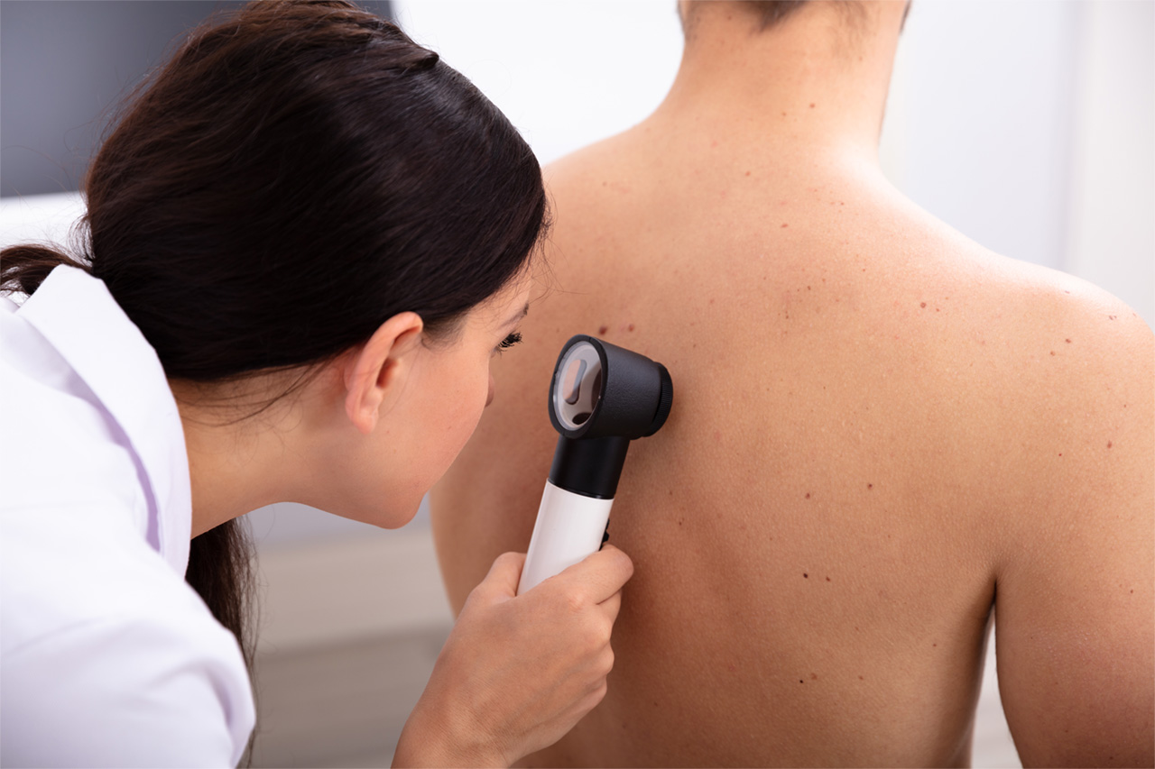 Doctor Examining Pigmented Skin On Man’s Back