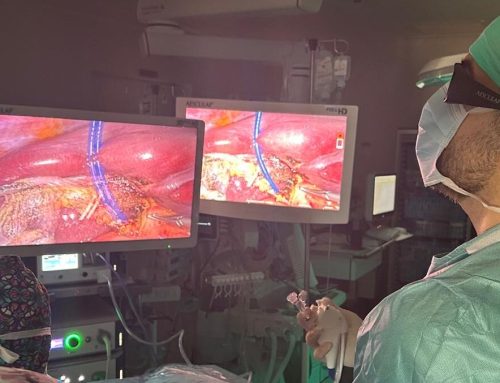 L’Hospital Joan XXIII, referent en una tècnica que evita segones intervencions en pacients amb pedres a la vesícula i la via biliar