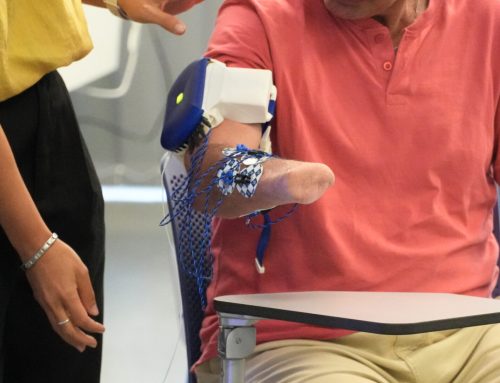 L’Hospital Joan XXIII avança en el tractament integral del dolor de membre fantasma