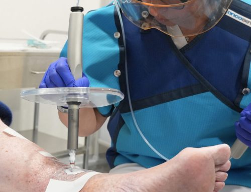 El Hospital Joan XXIII y el IDI incorporan un nuevo tratamiento para determinados cánceres de piel